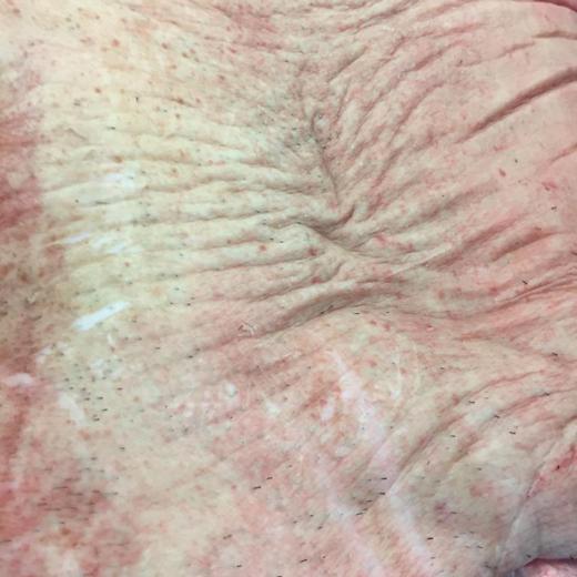 frozen pork belly bone in PRC APPROVED img2