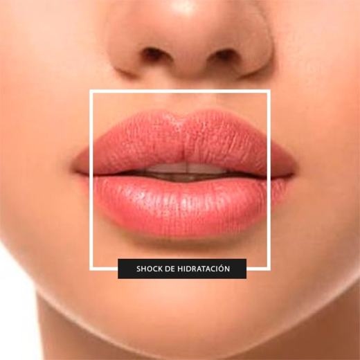 BOTOX BOTULINUM TOXIN TYPE A INJECTION img2